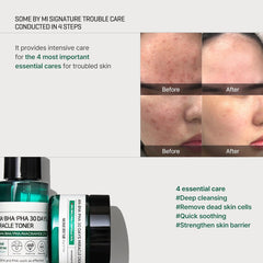 SOME BY MI AHA BHA PHA 30 Days Miracle Starter Kit - luut