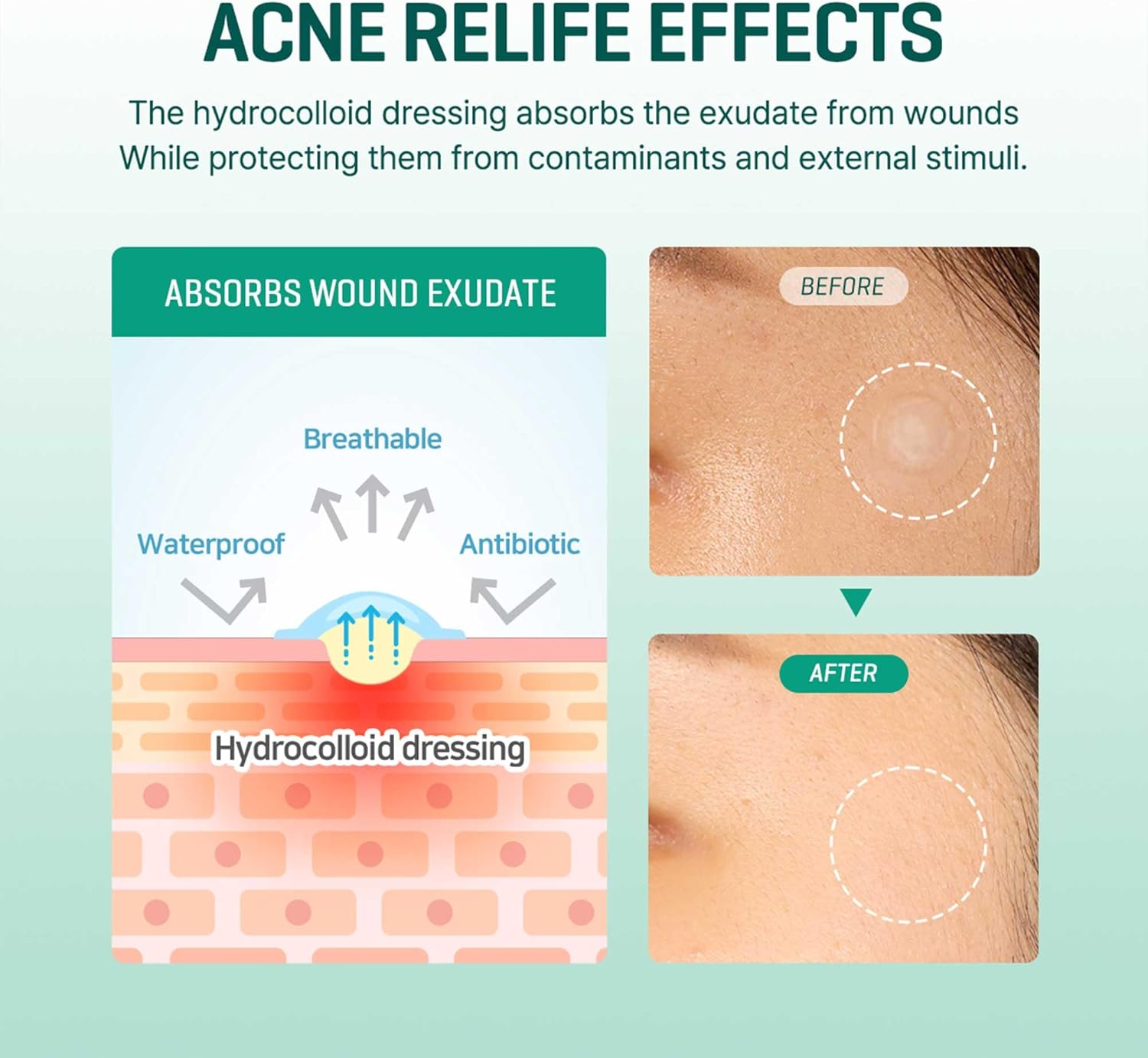 Some By Mi Clear Spot Patch (18pcs) - luut