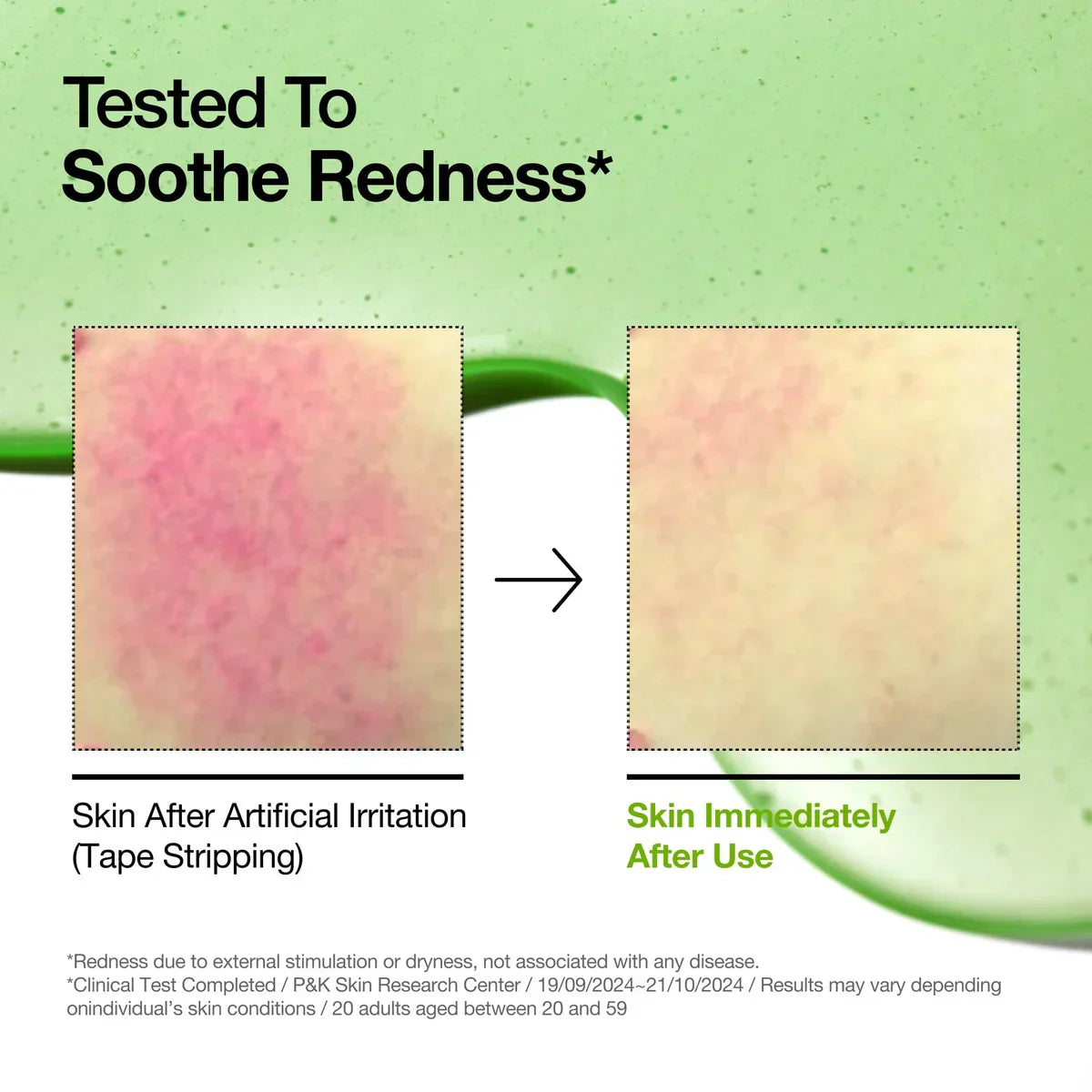 ANUA Azelaic Acid 10 Hyaluron Redness Soothing Serum - luut